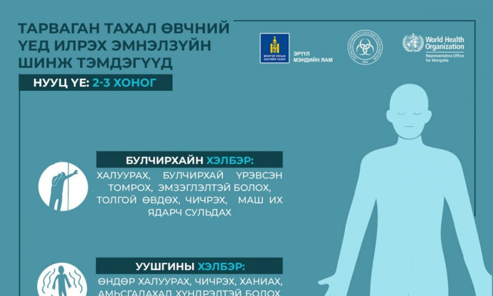 Тарваган тахал өвчний үед илрэх эмнэлзүйн шинж тэмдэг