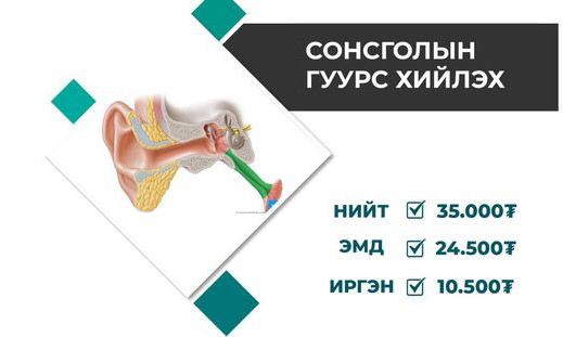 Даатгалаас сонсголын гуурс хийлэх шинжилгээг 70 хувь хөнгөлнө